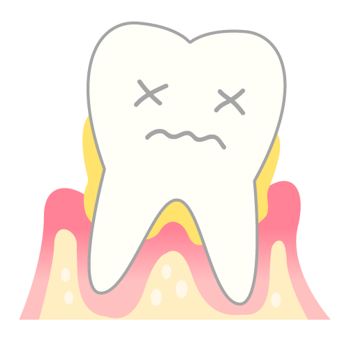 歯周病後期