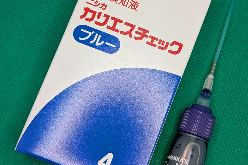 う蝕検知液で感染層だけ除去