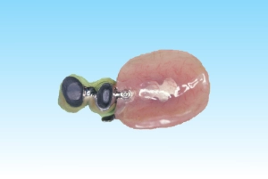 部分入れ歯スペシャルデンチャーの特長