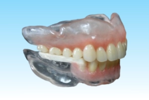 全部入れ歯スペシャルデンチャーの制作工程