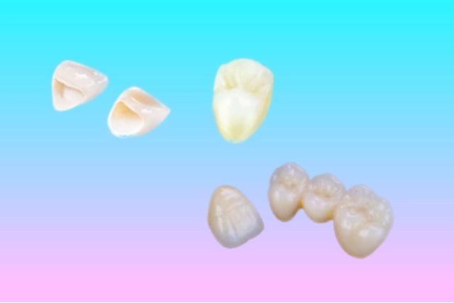 詰めもの・被せもの