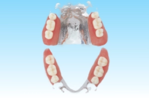 全部入れ歯スペシャルデンチャーの特長