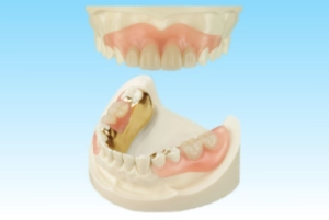 dentures