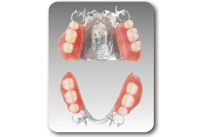 スペシャルデンチャー