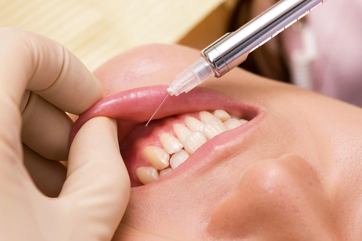 超極細針(33G)での麻酔